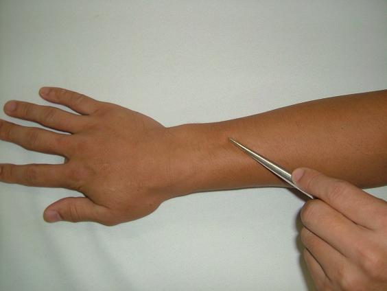 �O�֌��̎挊�ʐ^